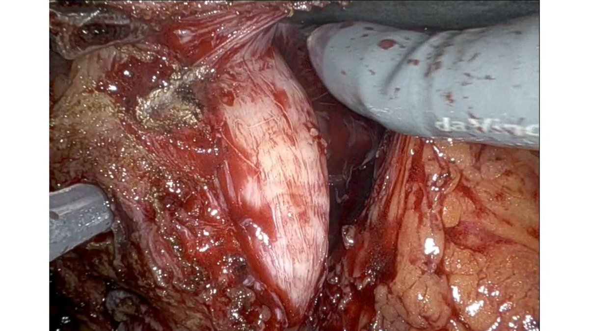 Franco Gaboardi tweet media