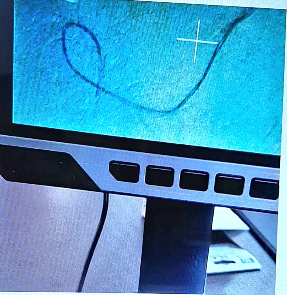 Ne olacak şimdi? 
#DrZaferKurugoelTutuklansın tweetleri yüzbinler olacak ama yarın,algoritma öğlen gibi yok edecek. Savcılar başlarını kuma gömecek ve!

Yanlışlıkla aşı olan bebekler en fazla 6 ay sonra graphene ile yüklenmiş olacak!
▪️Kimler,ne zaman ölecekler?Kimse bilmeyecek..