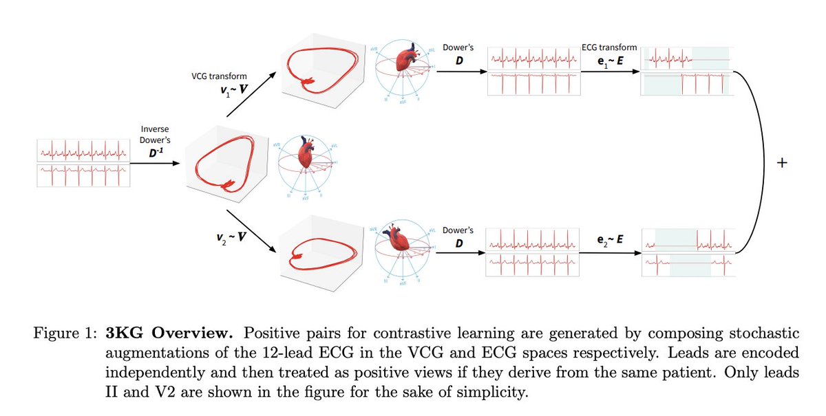 pranavrajpurkar's tweet photo. Excited to share our work on self-supervised learning for ECGs 🩺

With small fraction of labeled data, #3KG outperforms previous self-supervised methods and is close to fully supervised performance.

@bryan_gopal Ryan Han @realgurugautham w/ @GeoffTison 

https://t.co/zw05FnHRPS https://t.co/PzF0KKy2Ac