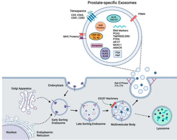 EdgarEGK's tweet photo. Exited to share a comprehensive and cool review about Exosomes as A Next-Generation Diagnostic and Therapeutic Tool in Prostate Cancer by Simita Gaglani @simitagaglani @IcahnMountSinai @dogranavneet 
https://t.co/x3pGVX05ny https://t.co/EGtuM0KI5S