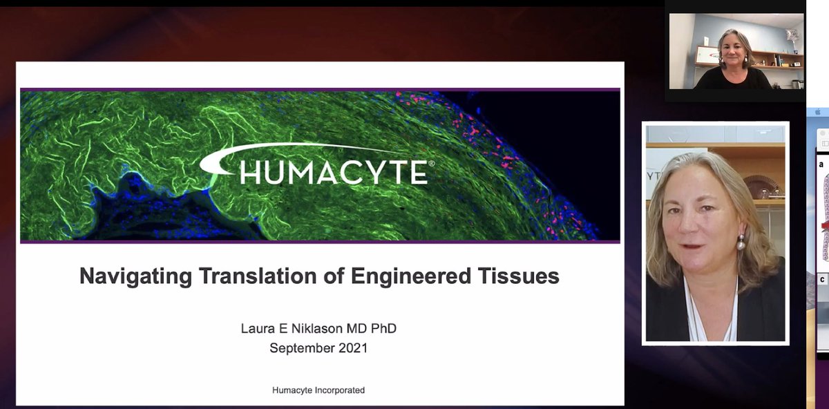 GVNlab's tweet photo. Day 2 of the #NextGenTissueEng Symposium continues with Session 4, #Translation! We start off the session with @DrLauraNiklason from @YaleBme @humacyte on "Navigating translation of engineered tissues" https://t.co/ywN9Z0AlCS