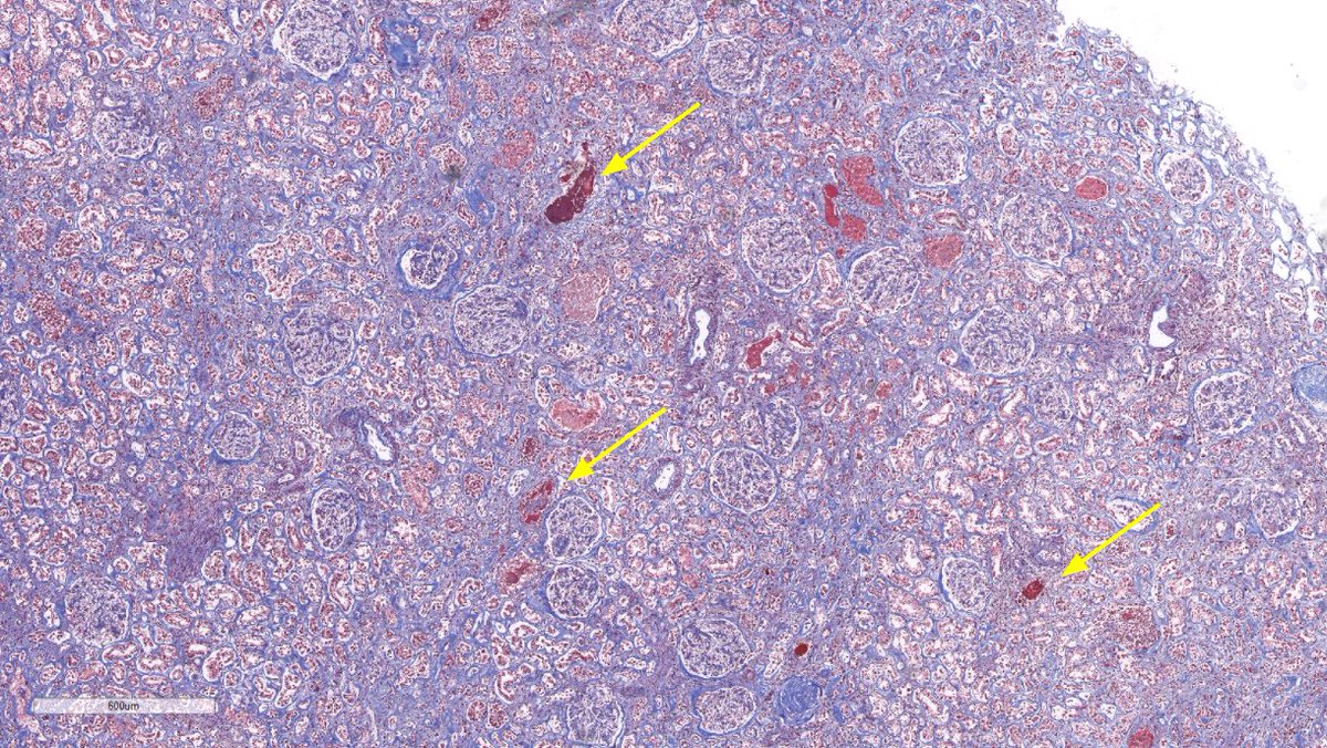 Jonathan Zuckerman MD PhD tweet media