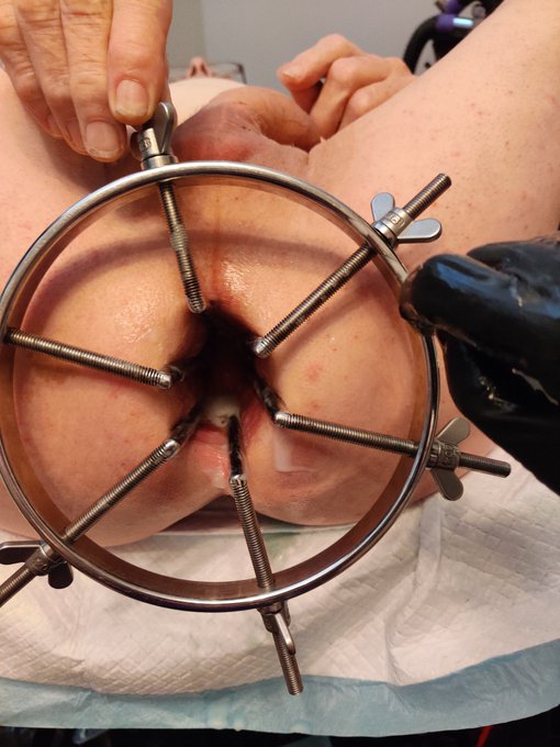 Look at that gape!! Great session on Tuesday, first time fisted and first time stretched this far! I<a href="/tag/mistress"class="tags"><span>#mistress</span></a><a href="/tag/milking"class="tags"><span>#milking</span></a><a href="/tag/seriouskit"class="tags"><span>#seriouskit</span></a><a href="/tag/seriouskit2"class="tags"><span>#seriouskit2</span></a>