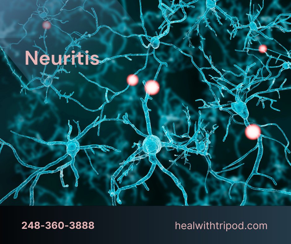 TripodLaser's tweet photo. #Neuropathy isn't the only nerve condition we treat! #pain stinks, so why live with it if you don't have to? #mlslasertherapy https://t.co/npAXwu729H