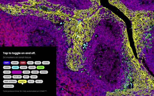 Did you know that with COMET™ you can visualize up to 40 markers on a single sample within a day? Check out this 24-plex tonsil tissue staining on our website. Tap to toggle each marker on and off.

➡️ lunaphore.com/products/comet/