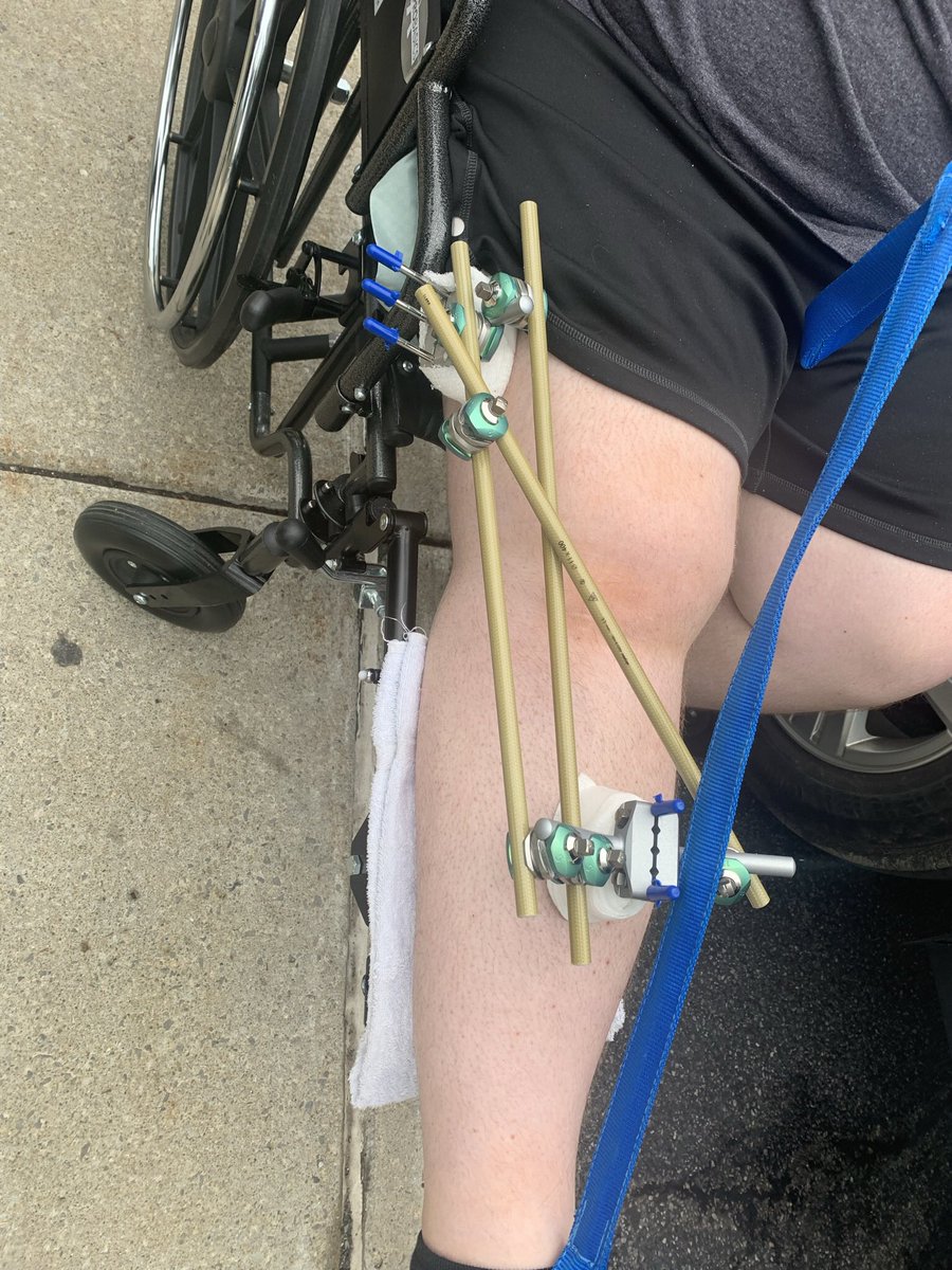 Hallerk97's tweet photo. Shit that didn’t age well. I did end up with a wheelchair 🙃 https://t.co/YW6bK2LKt3