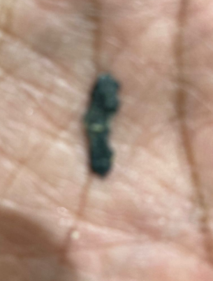 romero_rony's tweet photo. 5/10 Al abrir un paquete y comer varios de ellos..  mi sorpresa encontrar en una de las galletas  un trozo de metal (si de metal) estampado también en la galleta. En este momento vi lo peligroso de la situación ya que no se trata unicamente del tema  de calidad https://t.co/v6No0SA1w6