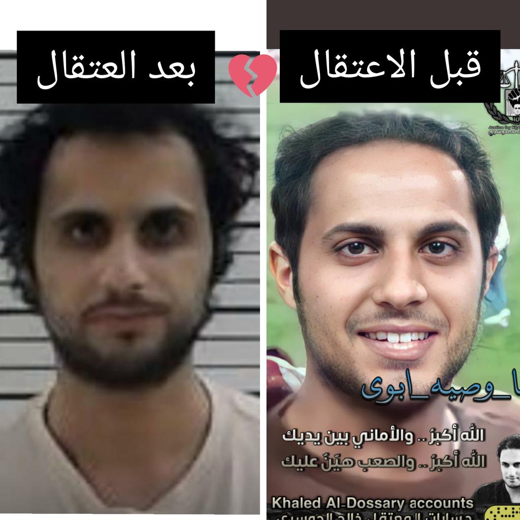 YGSEVadVGifP8OZ's tweet photo. 💔💔💔💔💔💔💔💔💔💔هذا الصوره مؤلمه جدا جدا  #احساسك_في_صوره https://t.co/igKz79vHe6