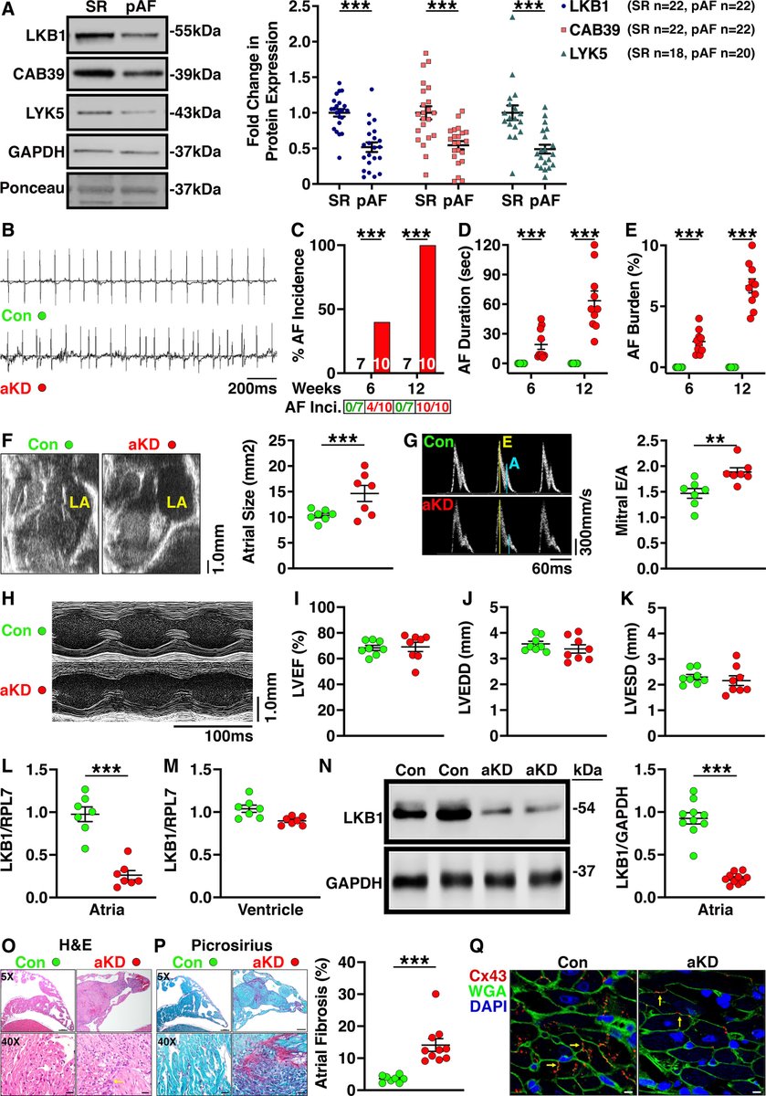 #ResearchLetter Atrial-Specific LKB1 Knockdown Represents a Novel Mouse Model of Atrial Cardiomyopathy with Spontaneous Afib ow.ly/tNw850G9N9t #AHAJournals @QriusScientist @lahiri_satadru @svetlana_reilly @XWehrens @bcmhouston @BCM_CVRI