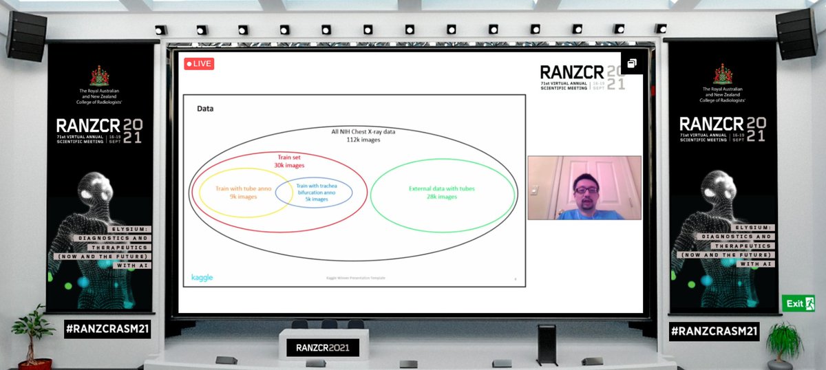 #RANZCRASM21 Tune in to AI Session 4 to hear Kaggle Grandmaster Bo Liu <a href="/boliu0/">Bo</a> talk about his incredible first-place winning approach to the inaugural RANZCR CLiP Challenge!