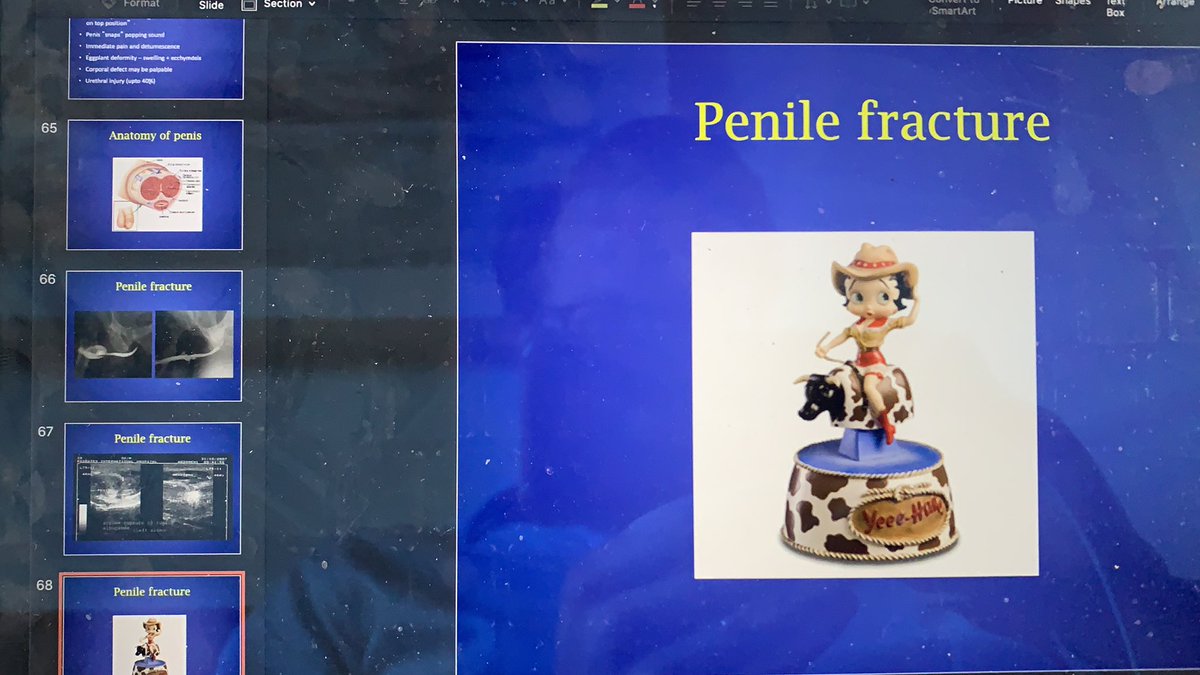 A strange note to finish another strange lockdown week on… giving the unsw students a tutorial on acute urologic conditions via Teams &amp; leaving them with this last slide on positions creating the highest risk of penile fracture😝.
Us urologists are a weird bunch…