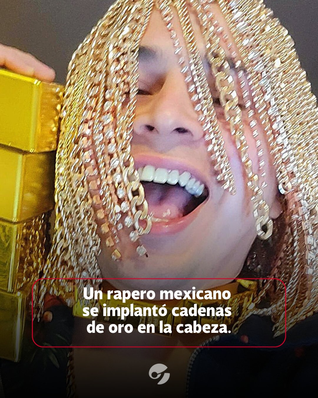 sal Subvención Naturaleza Clarín on Twitter: "El rapero mexicano, Dan Sur, se implantó cadenas de oro  como cabello. https://t.co/6gKFEnr4Uf" / Twitter