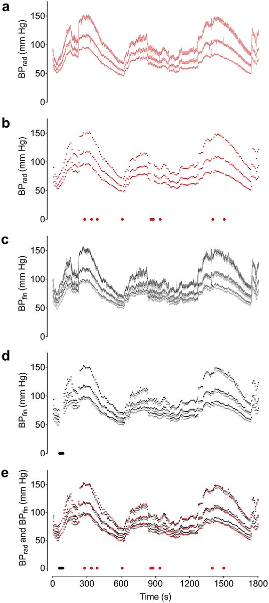 British Journal of Anaesthesia (@bjajournals) on Twitter photo Ipsilateral and contralateral validation of continuous noninvasive finger blood pressure: does side matter?
<a href="/BJAJournals/">British Journal of Anaesthesia</a> <a href="/AnesAMC/">Anesthesiologie AMC</a>
bit.ly/39ct7Kn Ipsilateral and contralateral validation of continuous noninvasive finger blood pressure: does side matter?
<a href="/BJAJournals/">British Journal of Anaesthesia</a> <a href="/AnesAMC/">Anesthesiologie AMC</a>
bit.ly/39ct7Kn