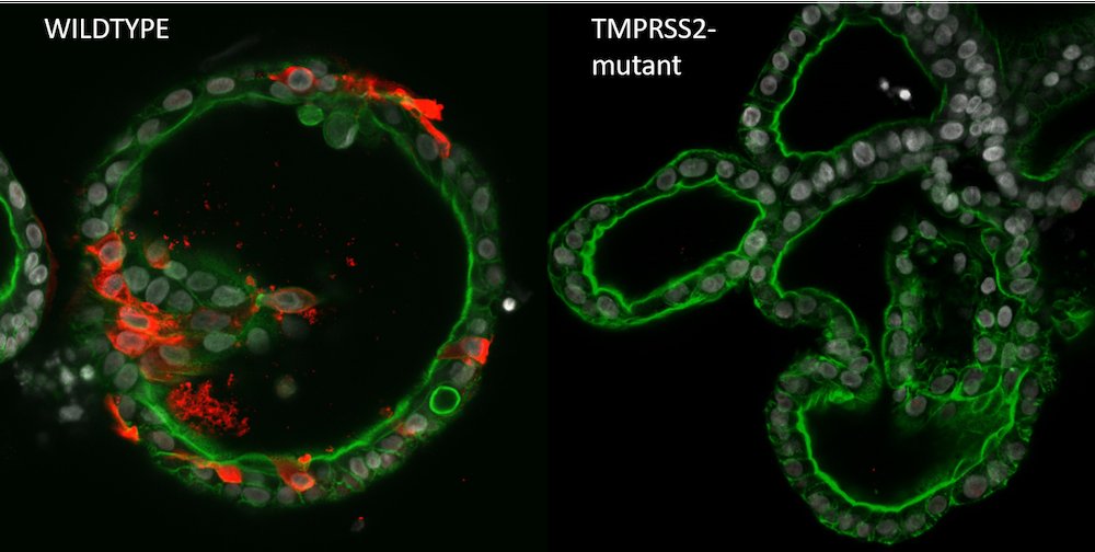The groups of <a href="/HansClevers/">Hans Clevers</a> and <a href="/bart_haagmans/">Bart Haagmans 🦠🐪 🤧</a> (<a href="/ErasmusMC/">Erasmus MC</a>) established an organoid biobank to search for the genes essential for the spreading of a SARS-CoV-2 infection. <a href="/BeumerJoep/">Joep Beumer</a> @geurts_maarten <a href="/MartLamers/">Mart Lamers</a> Published in <a href="/NatureComms/">Nature Communications</a>. hubrecht.eu/when-organoids…