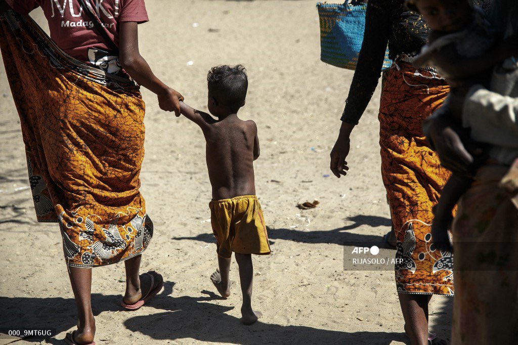 margothaddad's tweet photo. 🔴🇲🇬 #FOCALE
#Madagascar
Une famine sans précédent touche le sud de Madagascar depuis des mois. La sécheresse qui sévit est la plus grave depuis des décennies. De nombreux enfants souffrent de malnutrition tandis qu’une partie de l’aide est détournée.
📸Pic by @rijasolo https://t.co/HosMSZhWsx