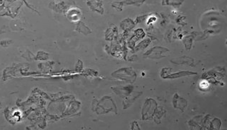 ToxSci's tweet photo. Chemicals in woodsmoke promote oxidative toxicity in skin cells #SkinHealth # toxicology @ucdavis https://t.co/avFC0xLDkB https://t.co/XcwrFkPmmC