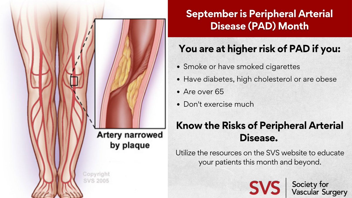 Don't forget that September is Peripheral Arterial Disease (PAD) Month and there are many online resources to utilize in your practice. Download the printable PAD flyer from the SVS to help your patients understand the disease this month and beyond: vascular.org/news-advocacy/…