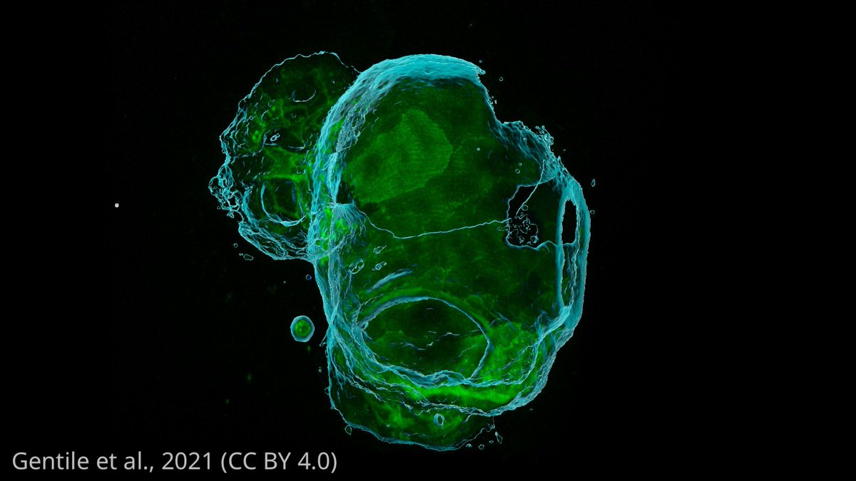 eLife's tweet photo. Genetic, transcriptomic, and chimeric analyses in zebrafish uncover the role of transcription factor Snai1 in maintaining the architecture of heart tissues https://t.co/9nAEayZ7Fi https://t.co/GDvkJOu2MI