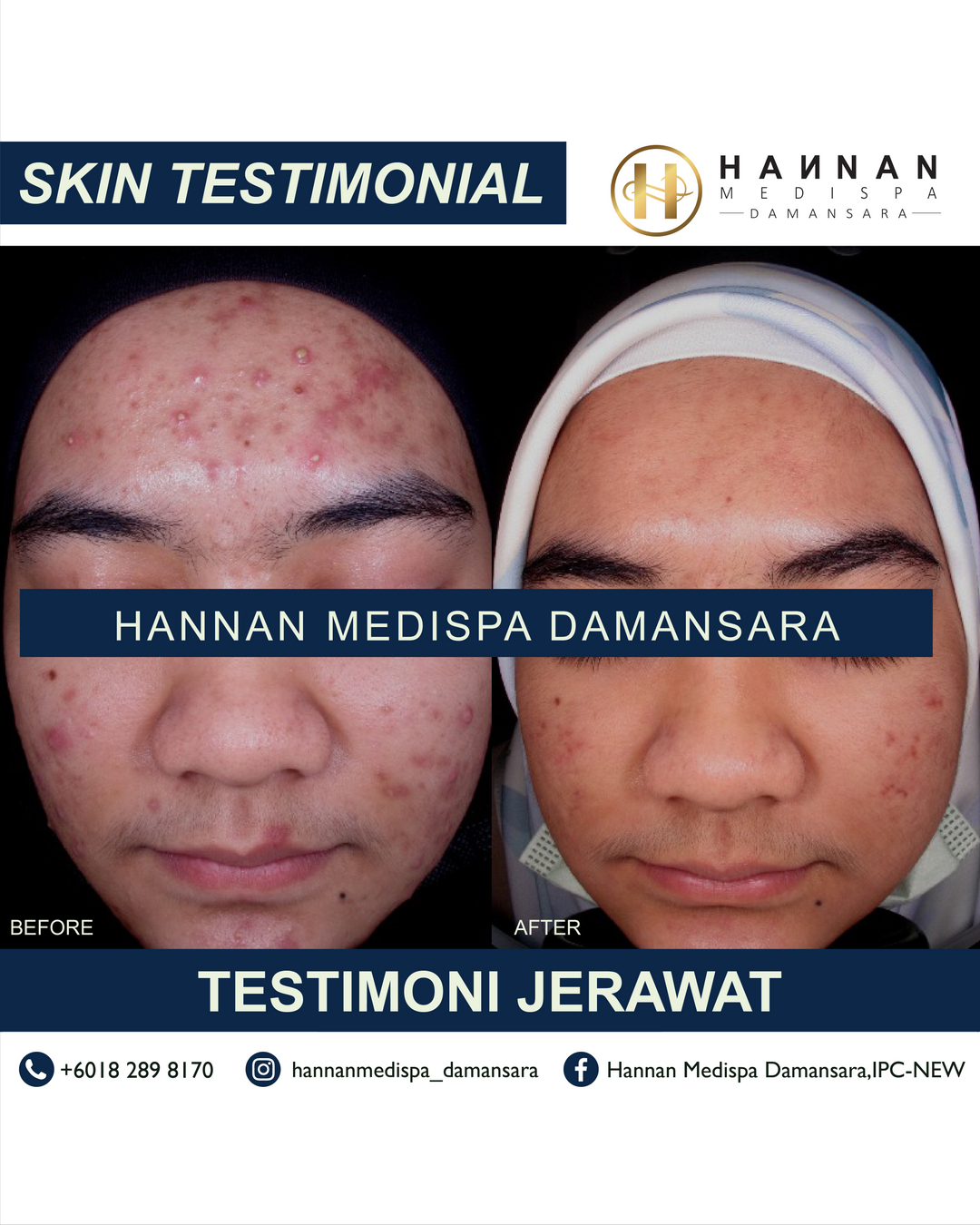 Medispa hannan Hannan Medispa