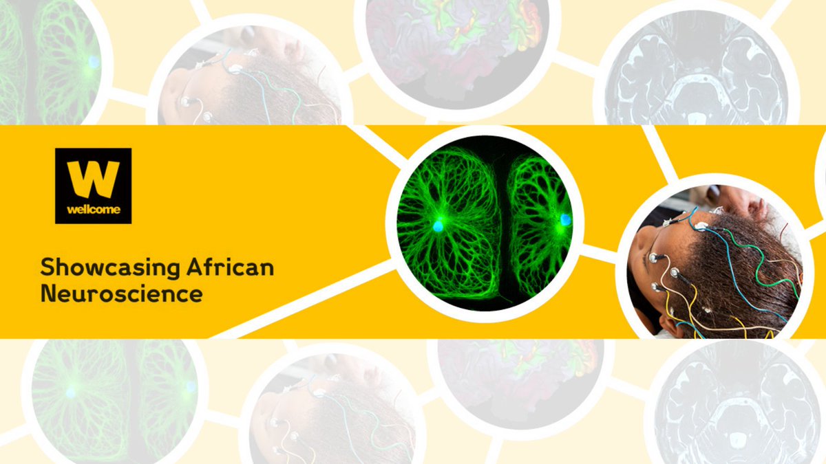 Wellcome Trust - Showcasing African Neuroscience -This meeting will bring together researchers, funders and journals to 1) Showcase some of the best examples of neuroscience research on the continent.
Registration is FREE and closes 24 September 2021
mailchi.mp/f19bd0f81428/w…