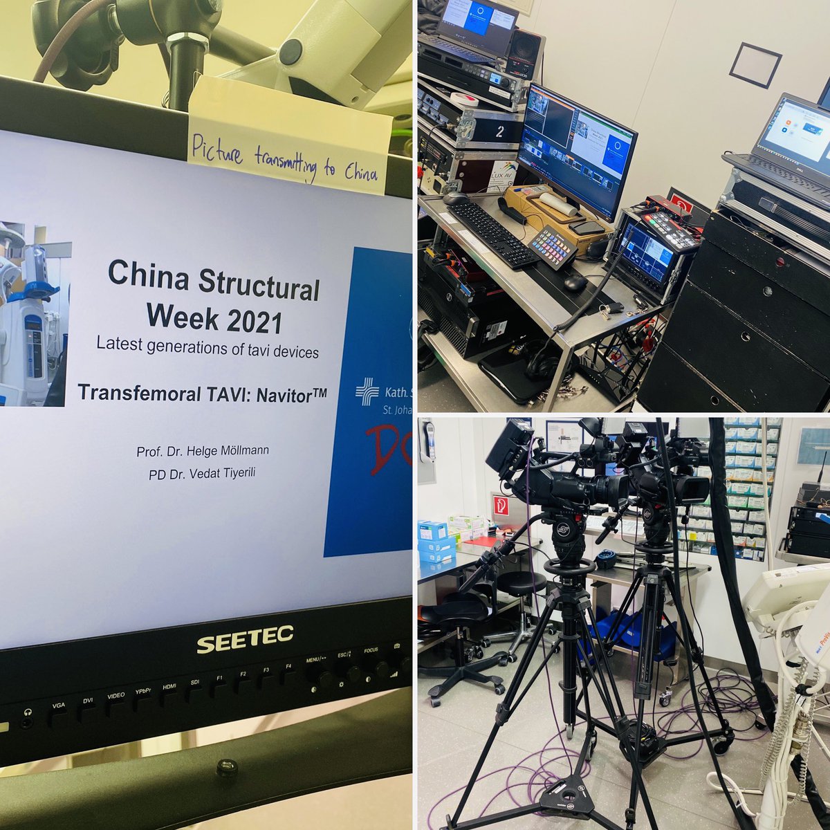 Vedat Tiyerili (@vtiyerili) on Twitter photo Successful Implantation of a Navitor TAVI valve during China Structural Week 2021.....
<a href="/AGIKinterv/">AGIK</a> <a href="/DGK_org/">Deutsche Gesellschaft für Kardiologie</a> <a href="/YoungDgk/">Young DGK</a> <a href="/escardio/">European Society of Cardiology</a> <a href="/PCRonline/">PCRonline 🫀</a> <a href="/EAPCIPresident/">EAPCIPresident</a> #cardiotwitter #aorticvalves #TAVI #JohoDortmund Successful Implantation of a Navitor TAVI valve during China Structural Week 2021.....
<a href="/AGIKinterv/">AGIK</a> <a href="/DGK_org/">Deutsche Gesellschaft für Kardiologie</a> <a href="/YoungDgk/">Young DGK</a> <a href="/escardio/">European Society of Cardiology</a> <a href="/PCRonline/">PCRonline 🫀</a> <a href="/EAPCIPresident/">EAPCIPresident</a> #cardiotwitter #aorticvalves #TAVI #JohoDortmund