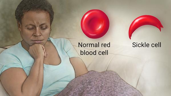 RepDonaldPayne's tweet photo. September is #SickleCellAnemia Awareness Month in hopes of bringing awareness to this disease. #SickleCellAnemia is an inherited disorder of the red blood cells that 1 in 12 African Americans genetically are carriers. #SickleCellMatters #SCDAA2021AwarenessMonth #SCDSCTmatters https://t.co/B1ZJ4vvhjR