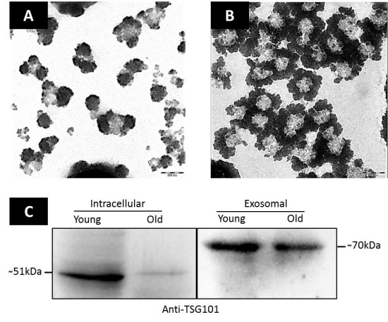 ajpheartcirc's tweet photo. #ArticlesInPress: Intracellular and exosomal microRNAome profiling of human vascular smooth muscle cells during replicative #senescence
(Nguyen et al.)
https://t.co/4UBln9cKlm
@UoNMalaysia
#aging
#PhenotypicSwitching
#ReplicativeSenescence
#CellularCommunication https://t.co/RPPH80mAYK