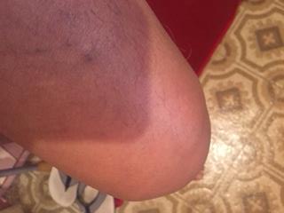 Goodcells's tweet image. Asi se me inflamaban las rodillas, codos, tobillos y dedos por LA GOTA (asido úrico) Gracias a los Micronutrientes ahora estoy libre de ese terrible problema, deberias de revisa este folleto online.fliphtml5.com/niajn/axys/
microdaily.com/jaf/home