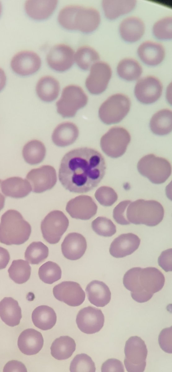 Tcho2A's tweet photo. Encore une belle illustration de la diversité cellulaire #ABM #STL #BTK #HEMATOLOGIE #CBPH #CROIXBASQUE https://t.co/Oi7XpnT9XS