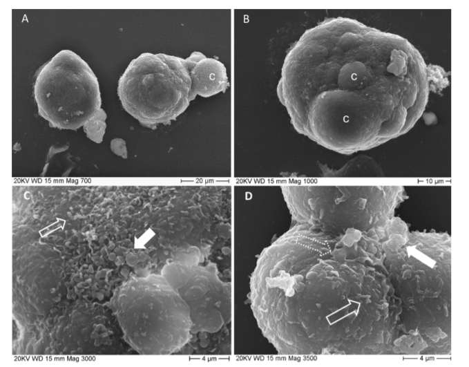 Biology_MDPI's tweet photo. The Ultrastructural Analysis of Human Colorectal Cancer Stem Cell-Derived Spheroids and Their Mouse Xenograft Shows That the Same Cells Types Have Different Ratios https://t.co/FBtBMKXhzP @SapienzaRoma @istsupsan
#spheroid #xenotransplant #cancer_stem_cell #colorectalcancer https://t.co/GfJbsw7AFb