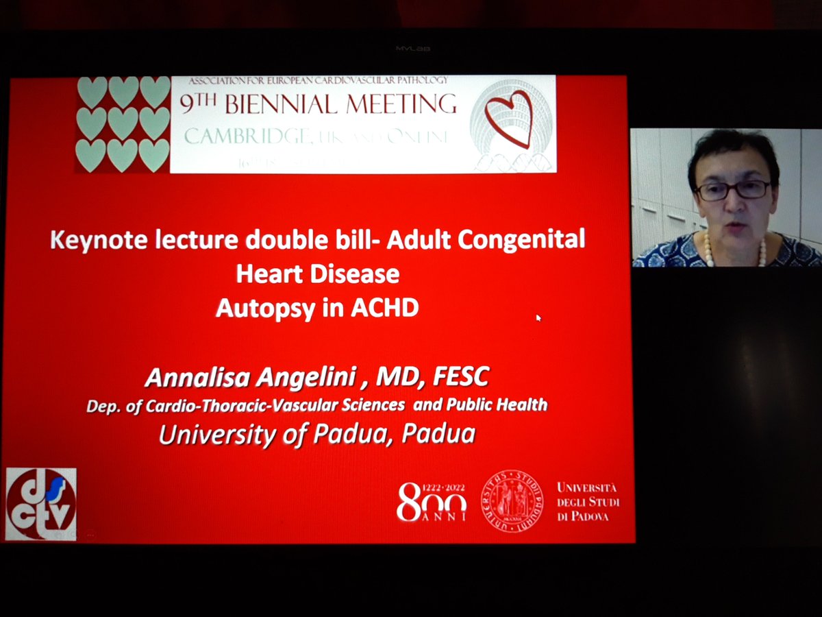 Ivana Kholová (@ivanakholova) on Twitter photo Keynote lecture double bill - Adult congenital heart disease by prof. Gatzoulis and prof. Angelini at <a href="/AECVPCam2021/">AECVP Cambridge 2021</a> 9th Biennial Meeting @Associa00047104 <a href="/stephendpreston/">Stephen Preston</a> #cardiacpath #CVpath Keynote lecture double bill - Adult congenital heart disease by prof. Gatzoulis and prof. Angelini at <a href="/AECVPCam2021/">AECVP Cambridge 2021</a> 9th Biennial Meeting @Associa00047104 <a href="/stephendpreston/">Stephen Preston</a> #cardiacpath #CVpath