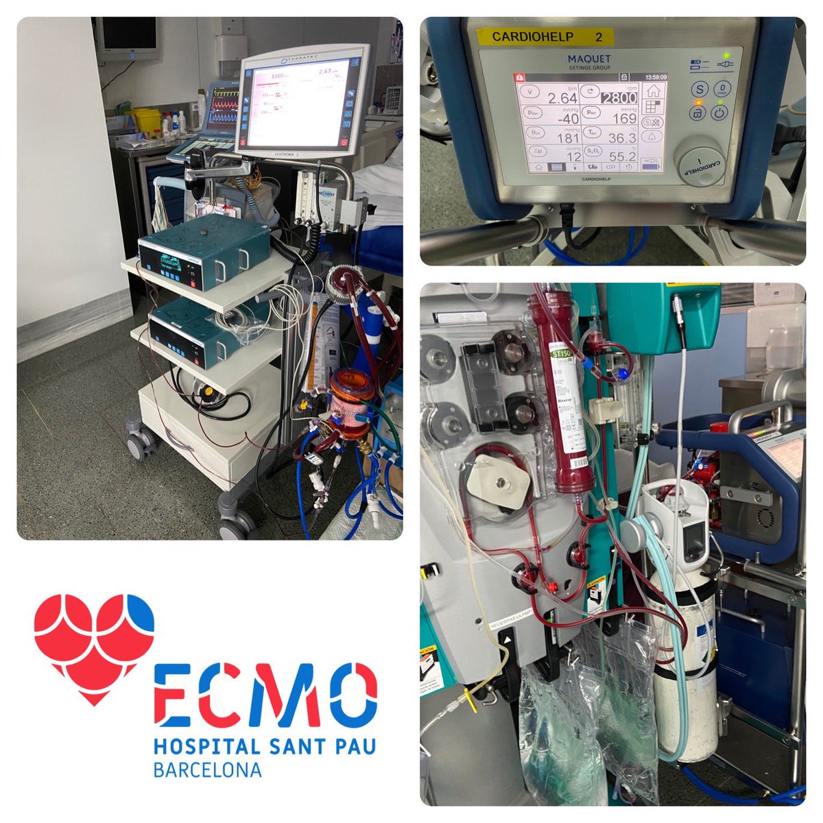 Alicia Pastor (@aliciapda) on Twitter photo #ecmo style!!! El ritmo que mantiene <a href="/UCISantPau/">UCISantPau</a> con <a href="/CardioSantPau/">CardioSantPau</a> y <a href="/AnestSantPau/">AnestesiaSantPau</a> Asistencia de Excelencia! <a href="/HospitalSantPau/">Sant Pau - Campus Salut Barcelona</a> #ecmo style!!! El ritmo que mantiene <a href="/UCISantPau/">UCISantPau</a> con <a href="/CardioSantPau/">CardioSantPau</a> y <a href="/AnestSantPau/">AnestesiaSantPau</a> Asistencia de Excelencia! <a href="/HospitalSantPau/">Sant Pau - Campus Salut Barcelona</a>