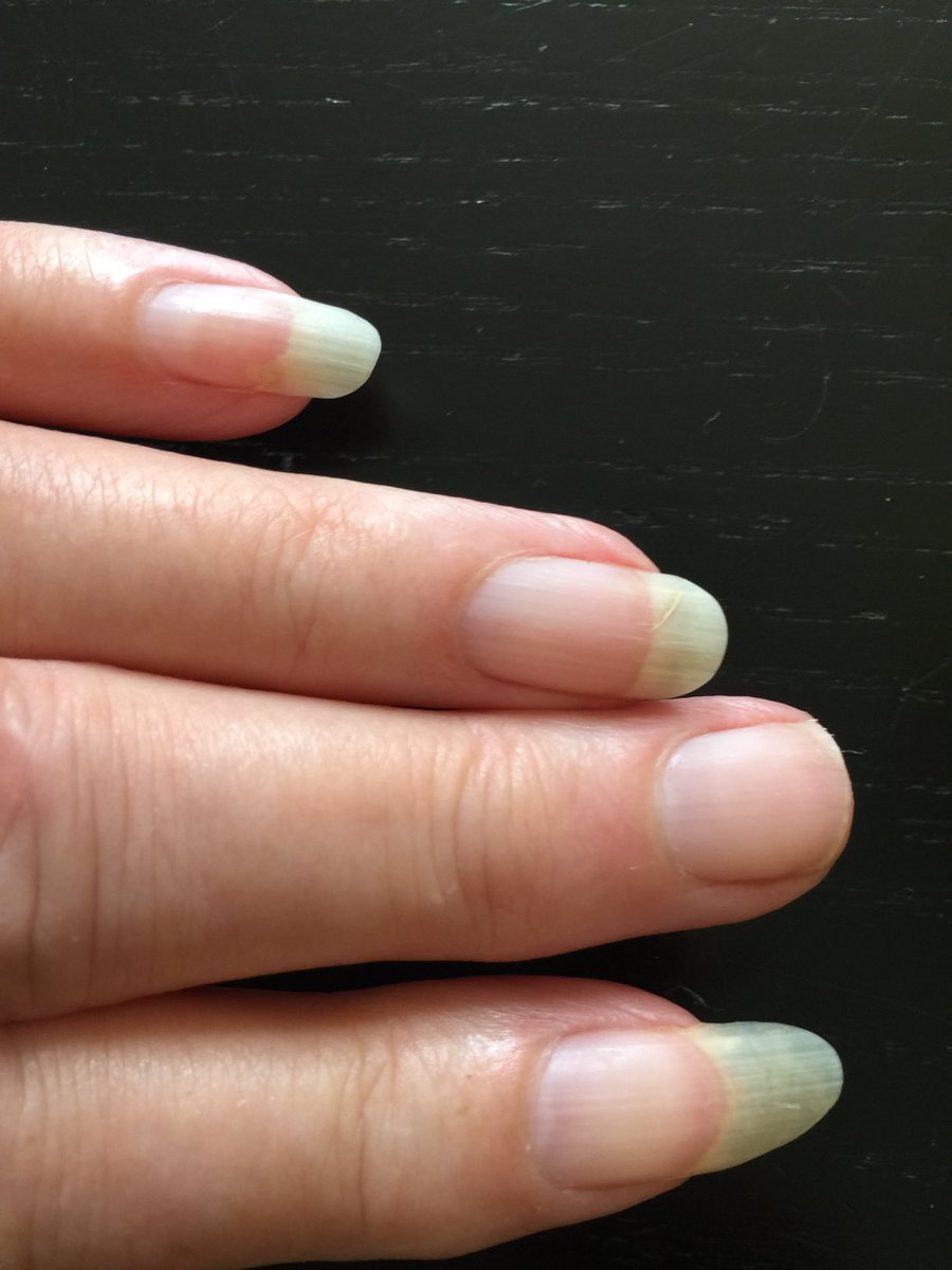 Ann Hawkins tweet media