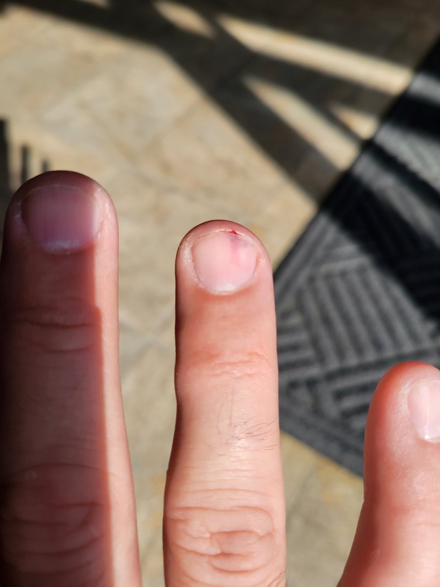 ConnerSpeed6's tweet image. Ayyy... #Shoutout to my PC for not working right now AND for nearly CUTTING OFF MY GAWD DAYUM FINGER!!! 🤬🤣🤨
#Dramatic #Overreaction