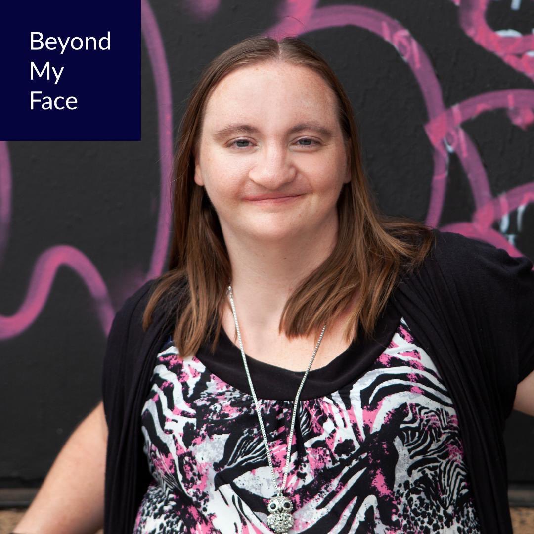 aboutface's tweet photo. “I believe the more we educate the public, the more opportunities for acceptance and awareness we create for our community.” - Pauline
BEYOND MY FACE.
VIDEO COMING SOON!
#BeyondMyFace
#CraniofacialAcceptanceMonth https://t.co/VydU8eiE3R