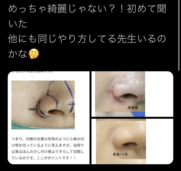みっけた

very.ne.jp/column/%E9%BC%…