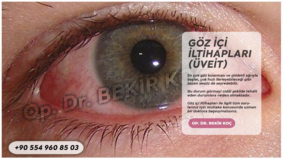 Malatya Göz Doktoru Op. Dr. Bekir Koç 
..
#opdrbekirkoç #malatya #malatyagözdoktoru #gözsağlığı #gözhastalıklarıuzmanı #gözcerrahisi #viretktomi #myom #gözhastalığı #gözsağlığıuzmanı