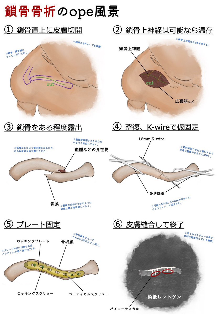 めりも Merimochan1 Twitter