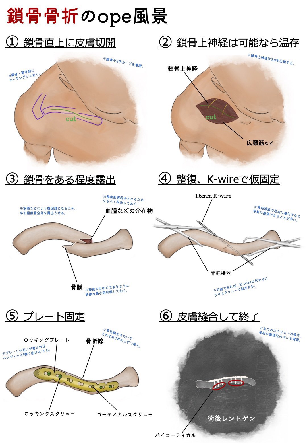 めりも Merimochan1 Twitter
