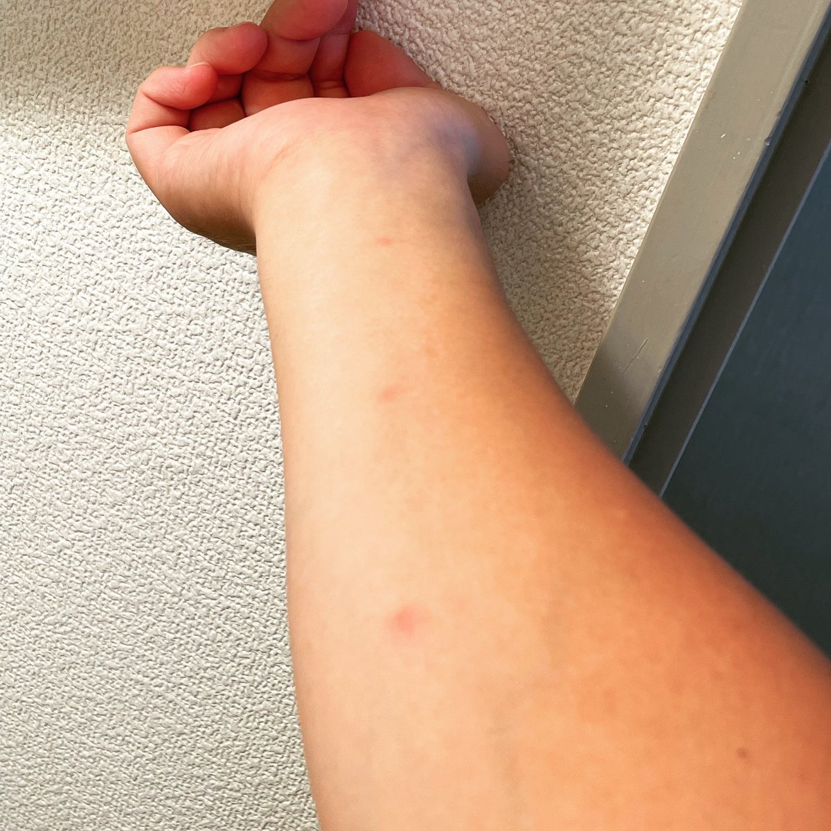 アレルギー検査したい