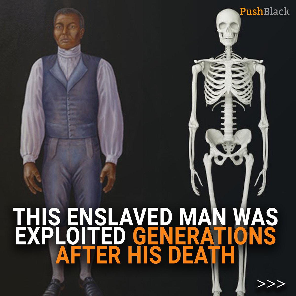 wearepushblack's tweet photo. As if slavery wasn't dehumanizing enough, this enslaved man was abused long after his death. You won’t believe what they did with his bones. #PushBlack #BlackHistory https://t.co/6f8wAOVajC