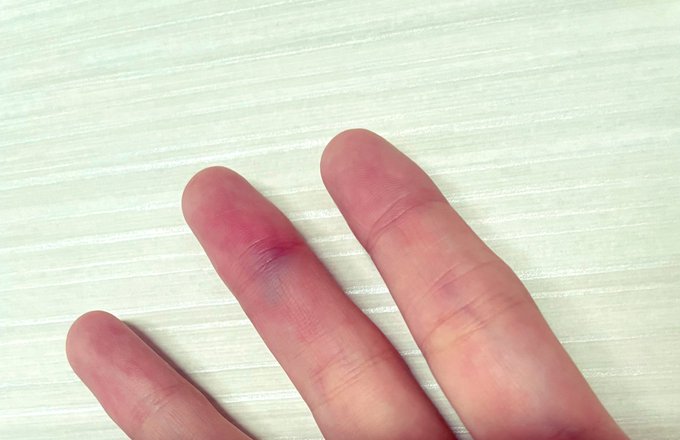 Watch ♥︎official_Hitomi♥︎'s leaked NSFW photo on TwXstars