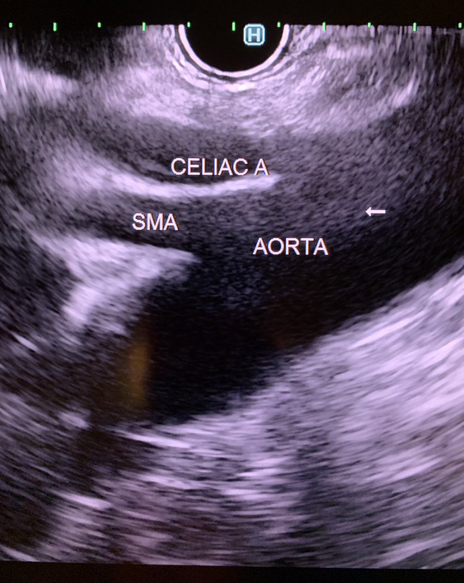 Neil Sharma, M.D. FASGE, FACG, AGAF tweet media