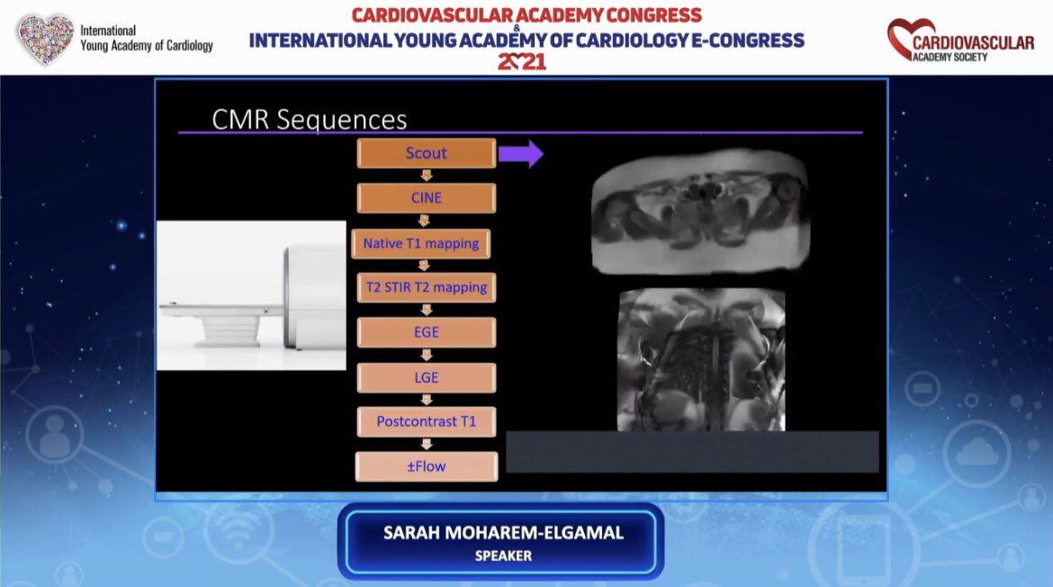 N_cardiologist's tweet photo. ‘Heart Failure ‘  session with great speakers .  When we should perform CARDIAD MRI in HEART FAILURE  patient? @Sarah_Moharem  is talking about this topic. @hatemsoliman @KemalogluOz @drmilicaa @iamritu @dr_maghraby @drmilicaa @yasminrust https://t.co/sKz0SQCohL