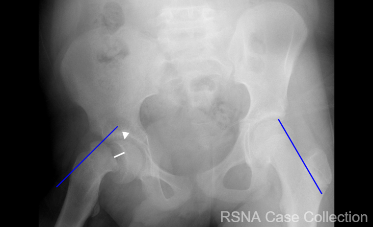 PGSharmaMD's tweet photo. Hopefully you didn’t “screw” up this weeks #RSNACC COW!   

Answer: https://t.co/iFAmviAC02 

Thanks @RSNA #RSNACC #MSKRad Deputy Ed Dr Kumaravel @MKMSKER @UTRadRes &amp; authors Drs. Tidwell and Saade and Amanda Schaaf! @uazmedphx @UAZHealth @CreightonPHX @valleywise_az @UofAZRads https://t.co/eAVy0FWZr9