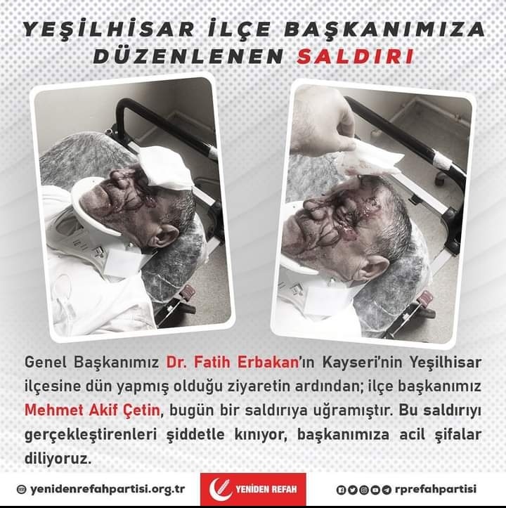 Hiç bir saldırı bizi Milli görüş davasından yıldıramaz!