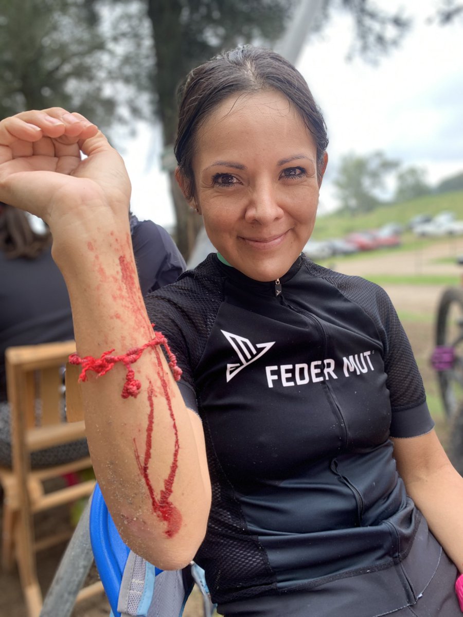 taniagabriel's tweet photo. Esta vez no me caí , me tiraron 😒 . Mi herida ya estaba sanando .
Después de subir #pinitos y bajar #espinazo , esta vez no volé 🙈😬 https://t.co/QwWI1Y6oaf