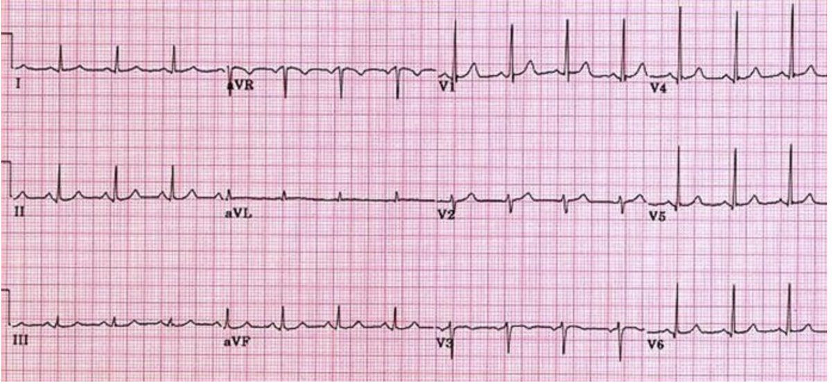 Time for a #tweetorial! In my medical training, I have seen several ...