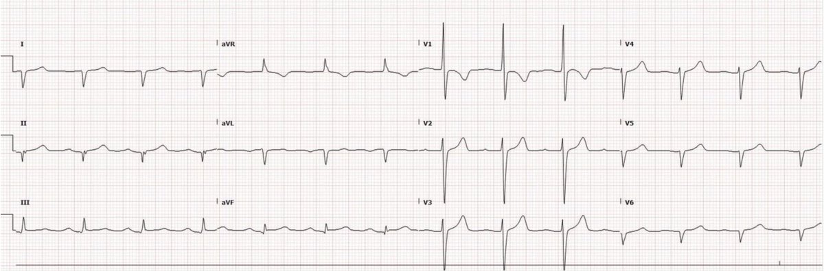 Time for a #tweetorial! In my medical training, I have seen several ...