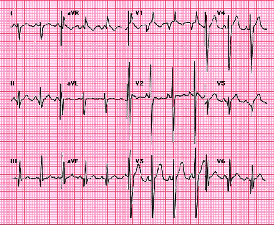Time for a #tweetorial! In my medical training, I have seen several ...